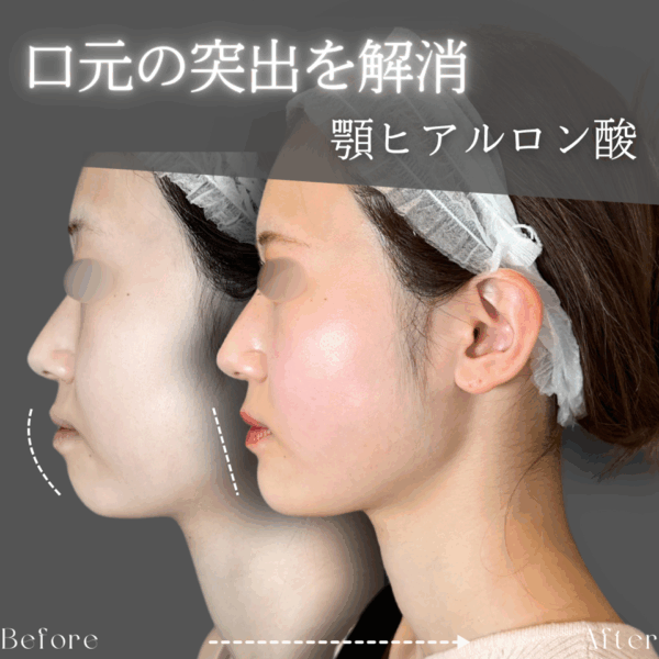No.8907の症例写真